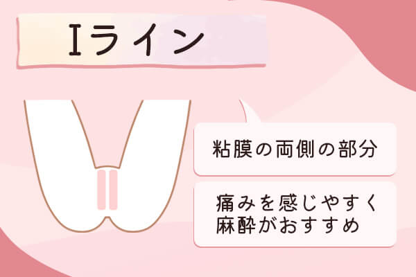 Iラインは粘膜の両側でVIO医療脱毛では痛みを感じやすい