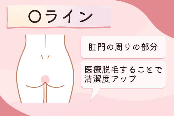 Oラインは肛門の周りの部分でVIO医療脱毛をすると衛生的
