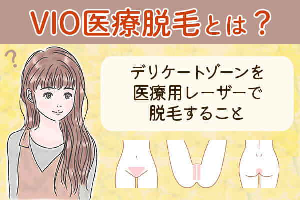 VIO医療脱毛とはデリケートゾーンを医療用レーザーで脱毛すること