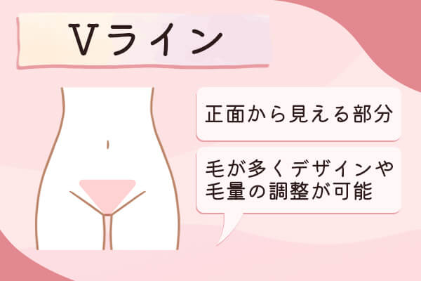 Vラインは正面から見える部分で医療脱毛でデザインや毛量を調整できる