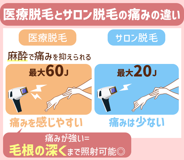 医療脱毛とサロン脱毛の痛みの違い