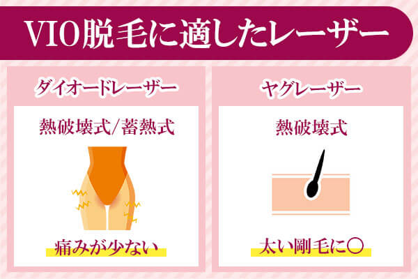 VIO医療脱毛のレーザーの種類