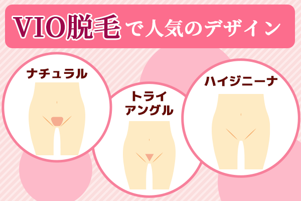 VIO医療脱毛で人気のデザイン