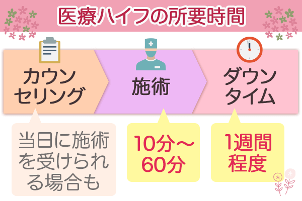 施術時間・ダウンタイムが短め!施術後メイクして帰ることもできる