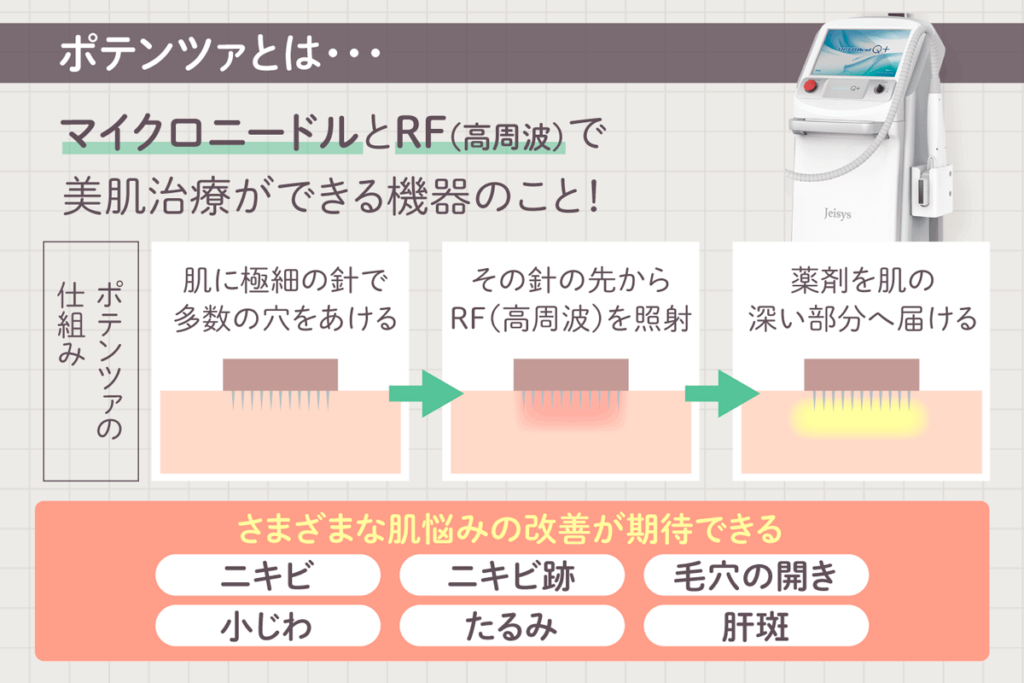 ポテンツァとはマイクロニードルとRF(高周波)で美肌治療ができる機器のこと