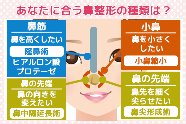 鼻整形の種類