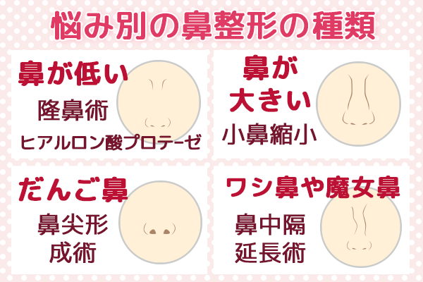 悩み別の鼻整形の種類