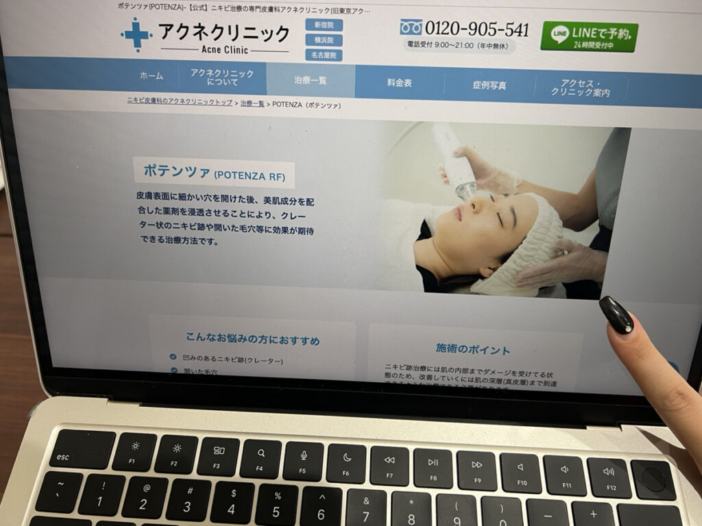アクネクリニック