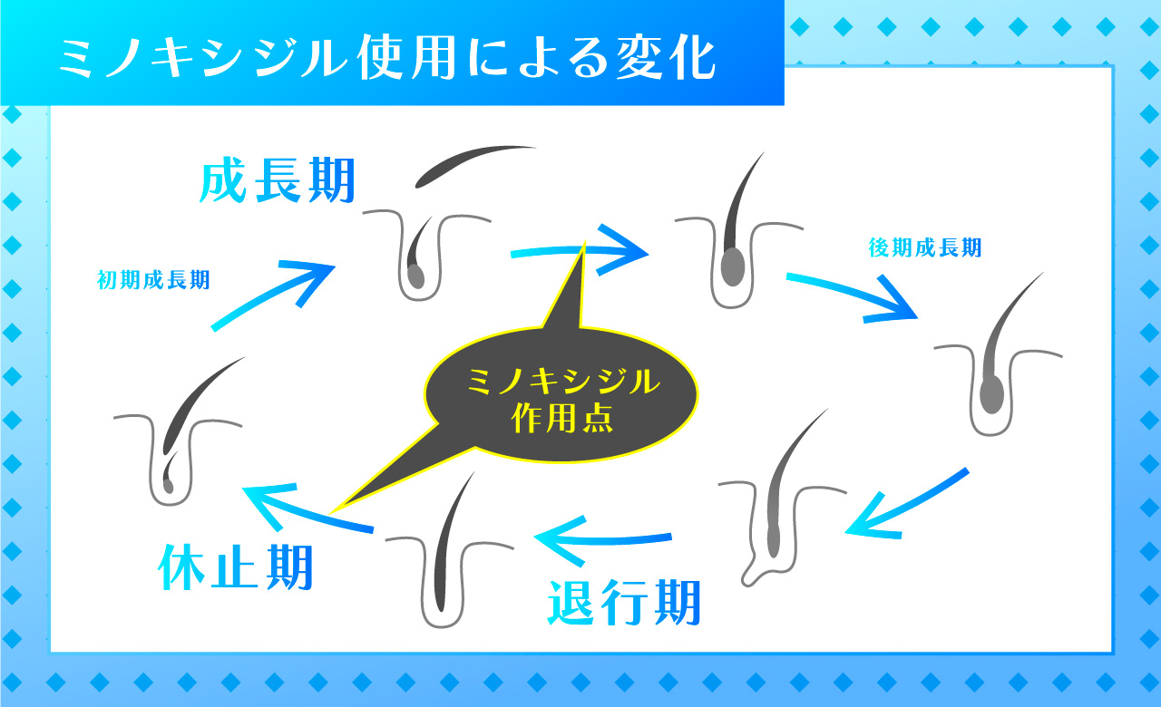 ミノキシジルの通販での効果について外用と内服画像