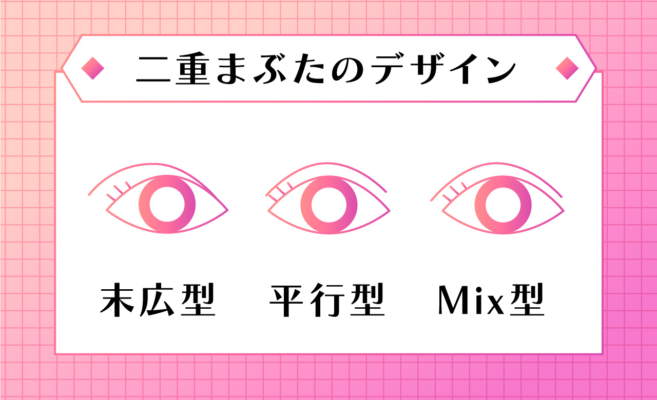 二重整形デザイン図解