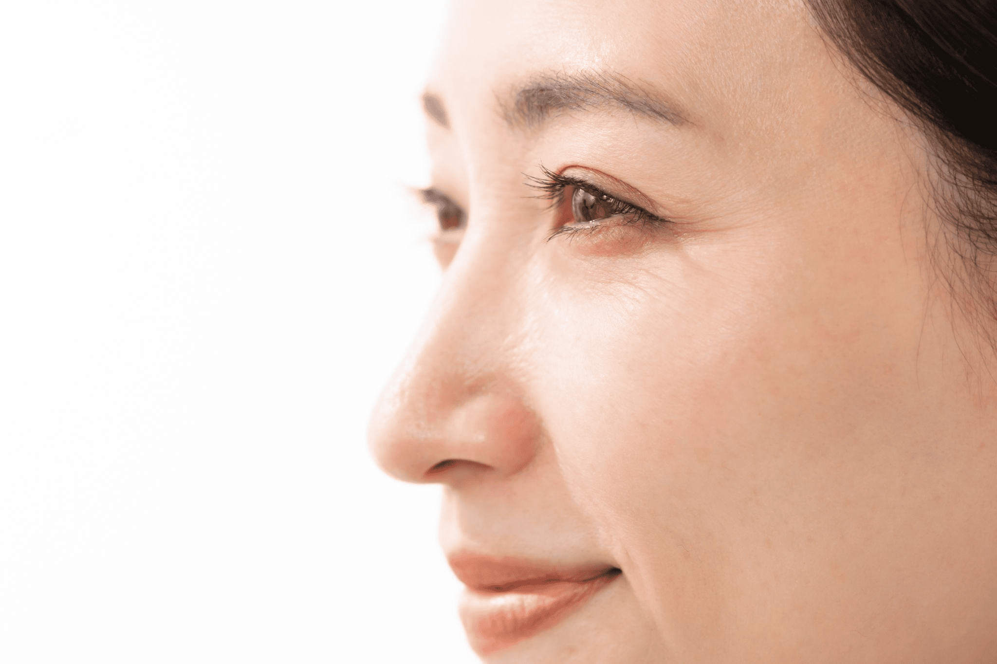 小じわ・ちりめんじわとは