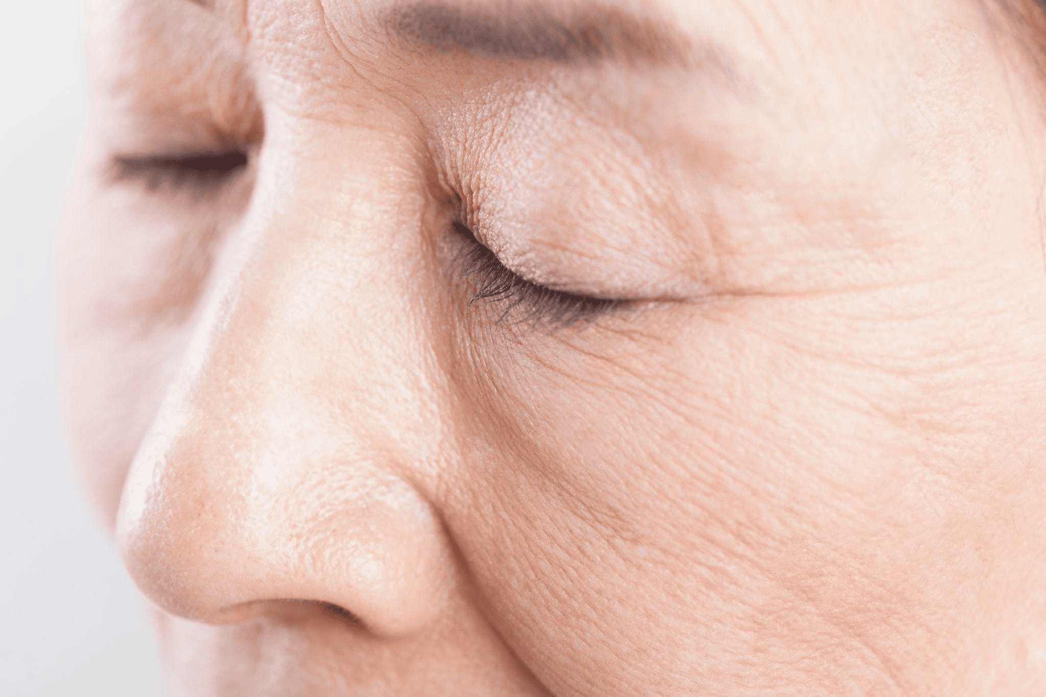 小じわ・ちりめんじわができやすい場所