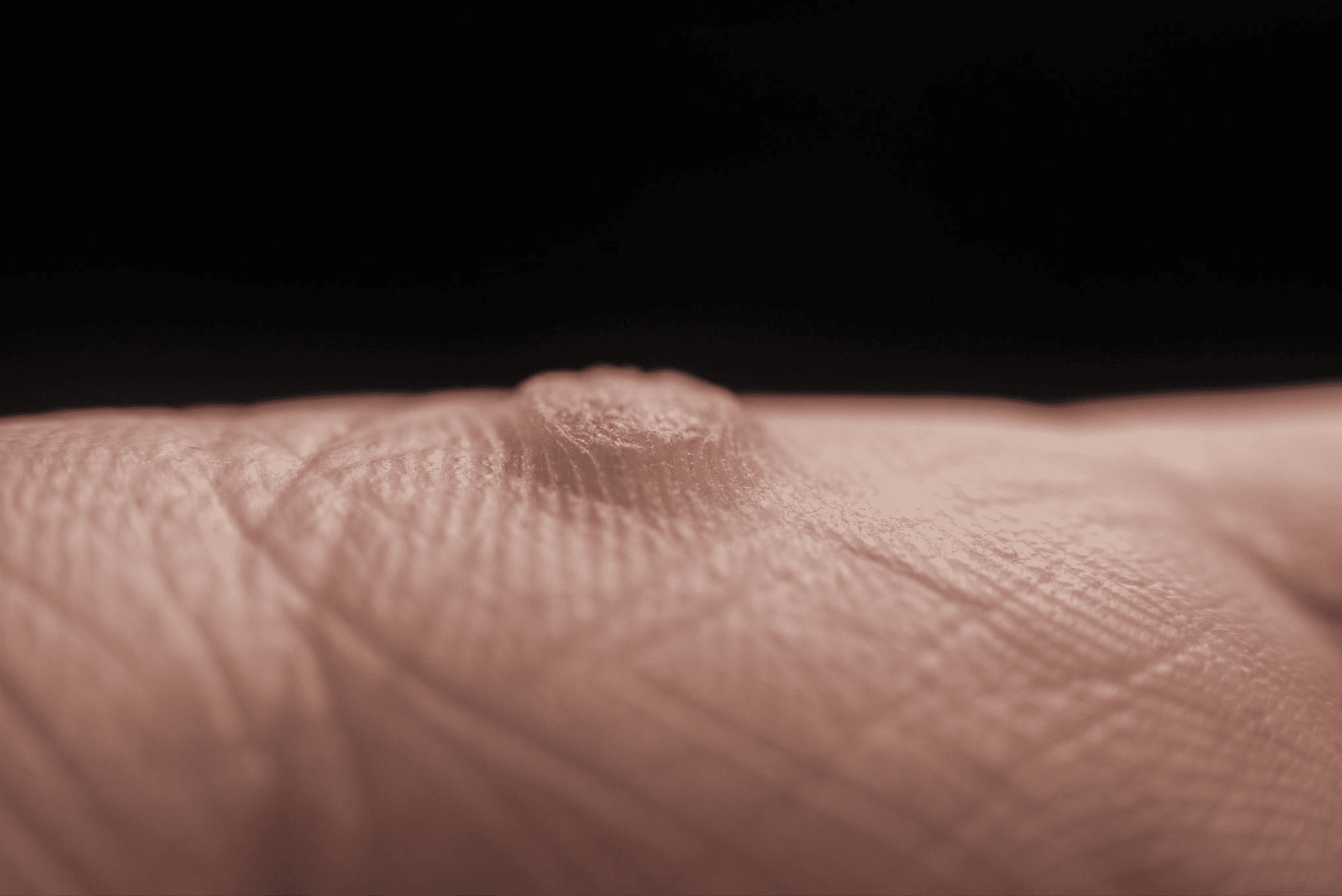 イボの良性・悪性の見分け方