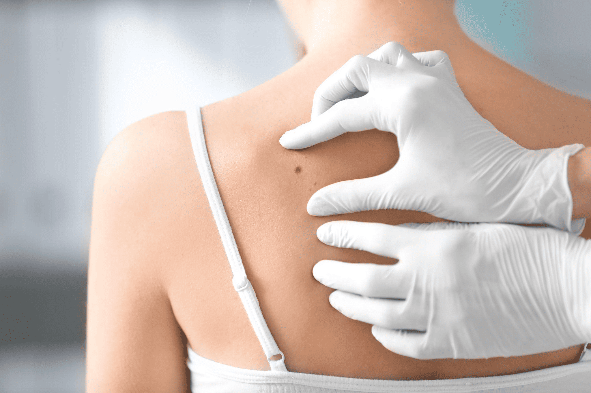 イボとホクロの違い