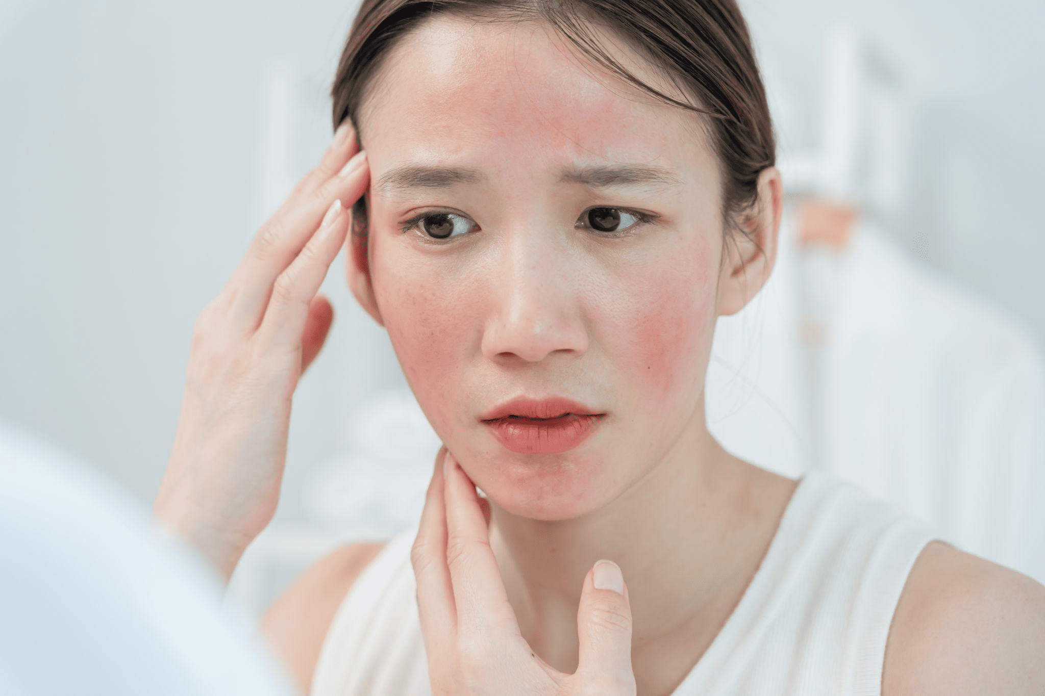 赤ら顔を即効で治す方法はある？