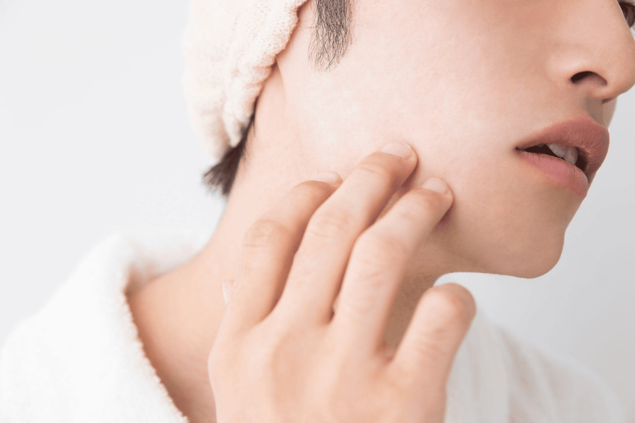 ニキビ跡の種類と治療法は？セルフケア方法も解説