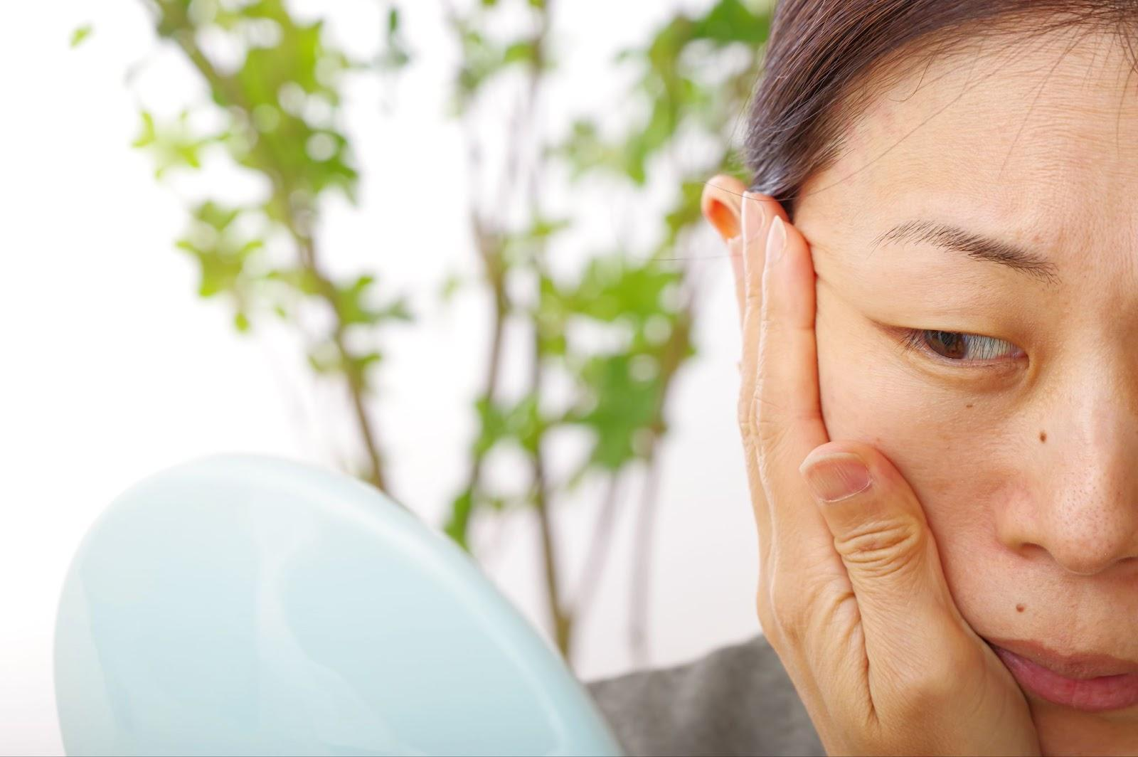 たるみ毛穴とは